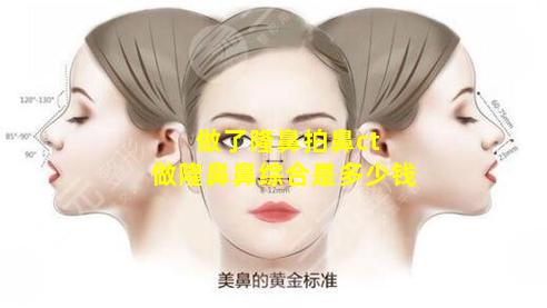 做了隆鼻拍鼻ct 做隆鼻鼻综合是多少钱